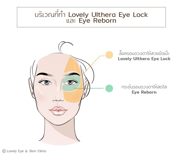 Lovely-Ulthera-eye-lock-ภาพประกอบ-1_1.jpg