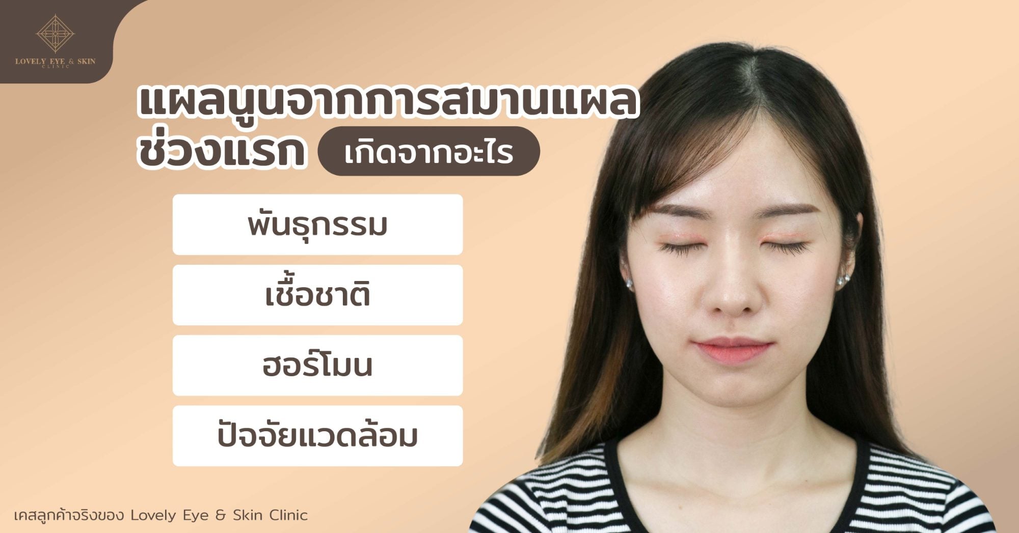 แผลนูนจากการสมานแผลช่วงแรก เกิดจากอะไร พันธุกรรม ฮอร์โมน เชื้อชาติ ปัจจัยแวดล้อม