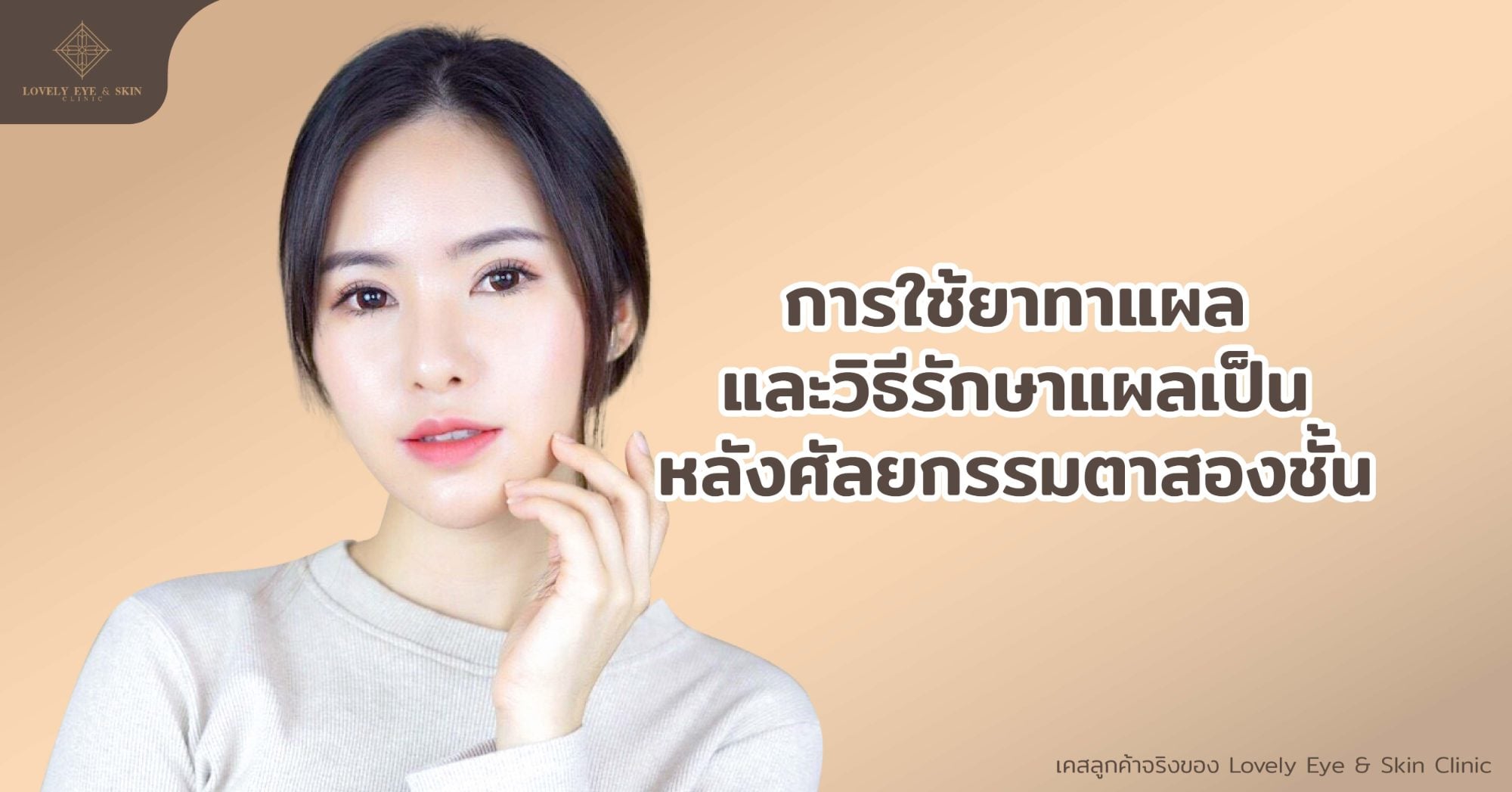 การใช้ยาทาแผลและวิธีรักษาแผลเป็นหลังศัลยกรรมตาสองชั้น