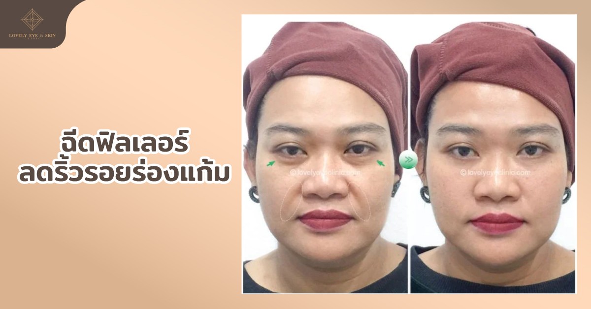 LovelyEye-Jan1-2.jpg