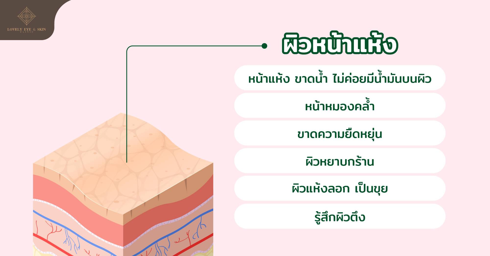 ผิวที่มีความแห้ง เป็นขุย แลดูหยาบกร้าน ขาดน้ำ อาจรู้สึกตึงๆ ผิว ไม่ค่อยมีความยืดหยุ่น