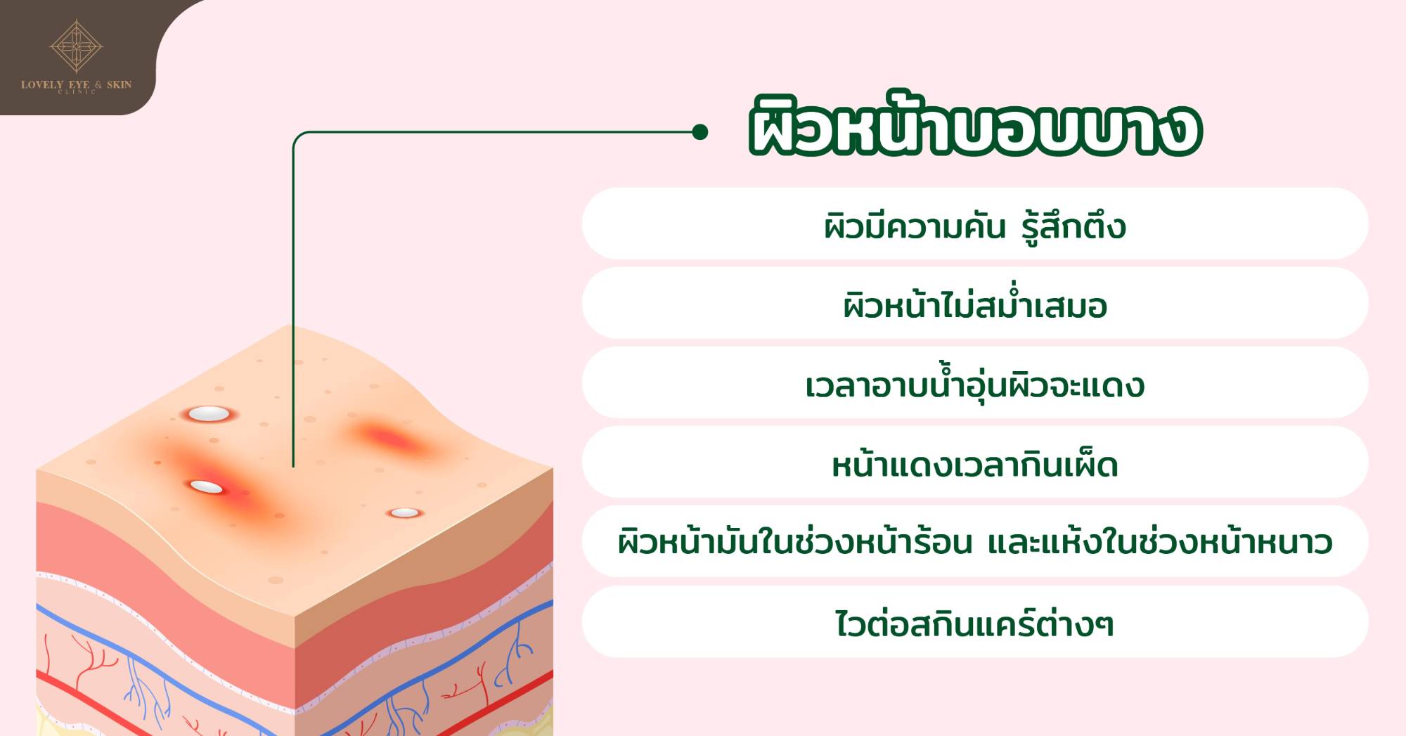 ผิวหน้าบอบบางเป็นประเภทผิวหน้าที่เกิดการระคายเคืองได้ง่าย และตอบสนองกับสิ่งต่างๆ