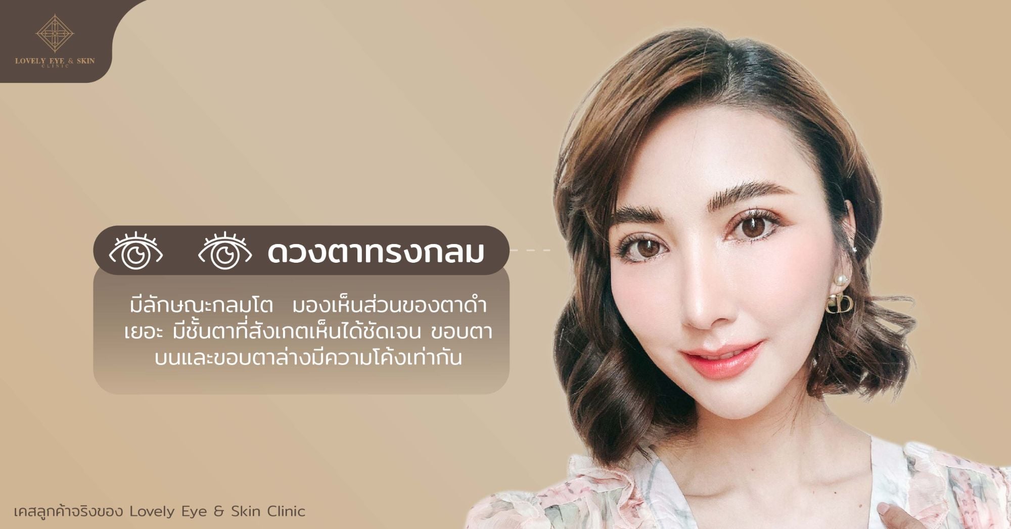 ตาทรงกลม คือมีลักษณะกลมโต มองเห็นตาดำเยอะ มีชั้นตาชัดเจน ขอบตาบน-ล่างมีความโค้งเท่ากัน