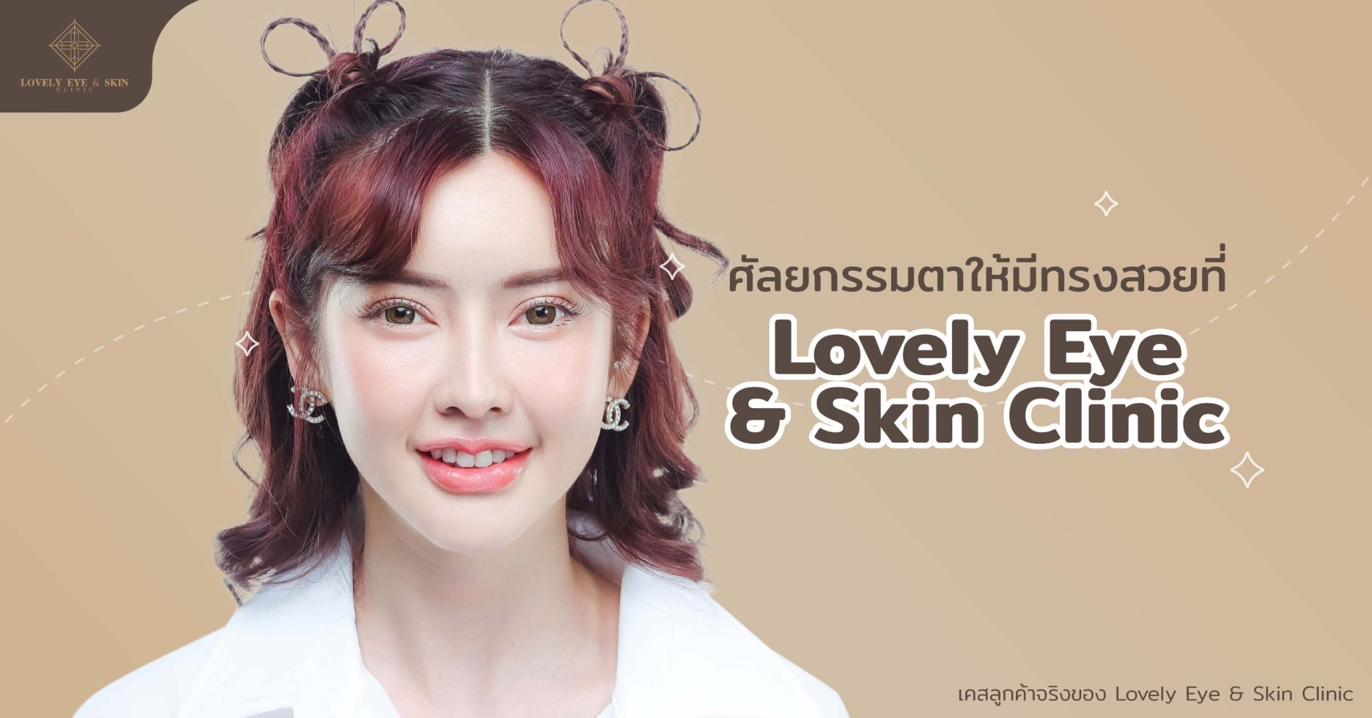 ศัลยกรรมตาให้มีทรงสวยที่ Lovely Eye & Skin Clinic ดีอย่างไร?