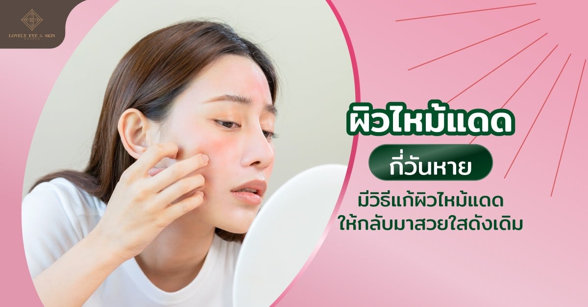 ปัญหาผิวไหม้แดด พร้อมทั้งบอกวิธีแก้ผิวไหม้แดดที่ถูกต้อง