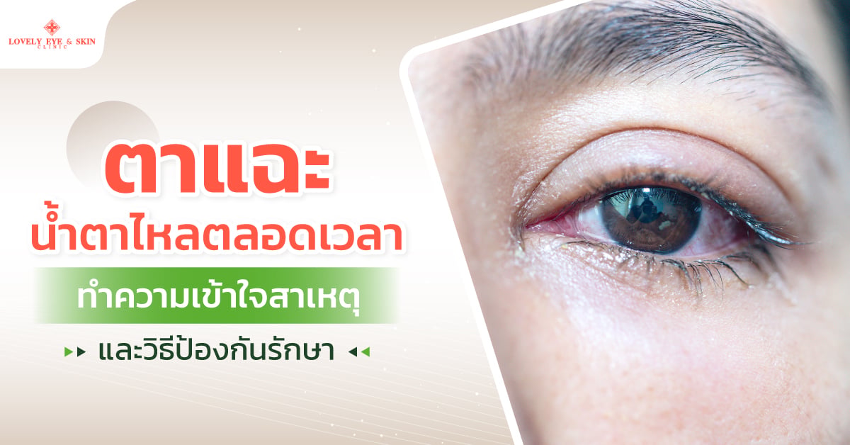 ตาแฉะเกิดจากอะไร
