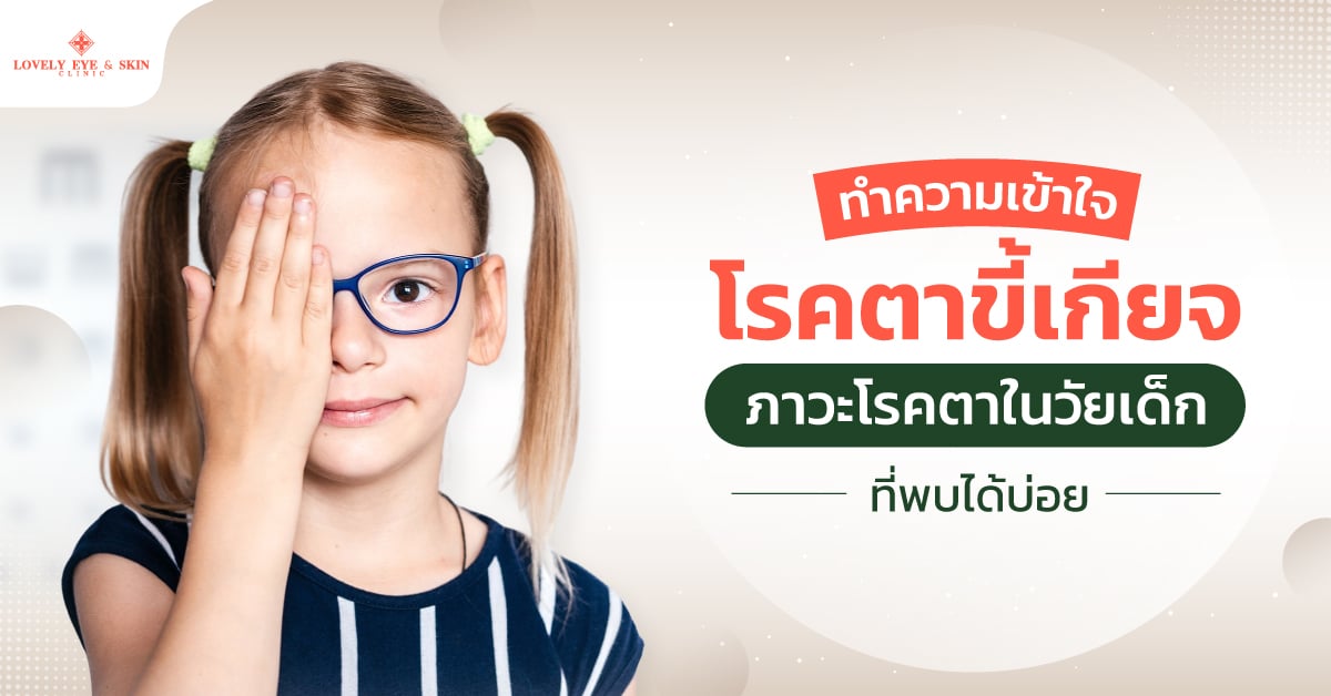 ตาขี้เกียจ คือ