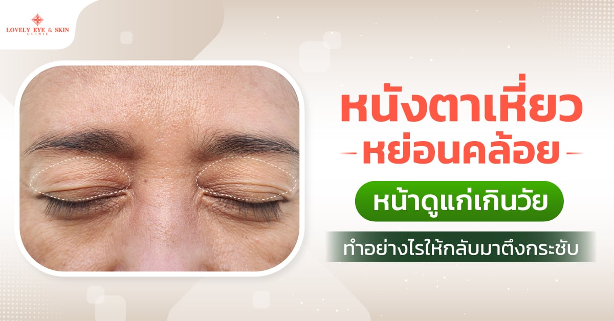หนังตาเหี่ยว ตาแก่