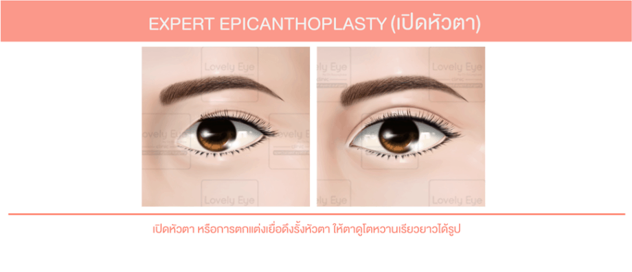 ทำตาสองชั้น เปิดหัวตา