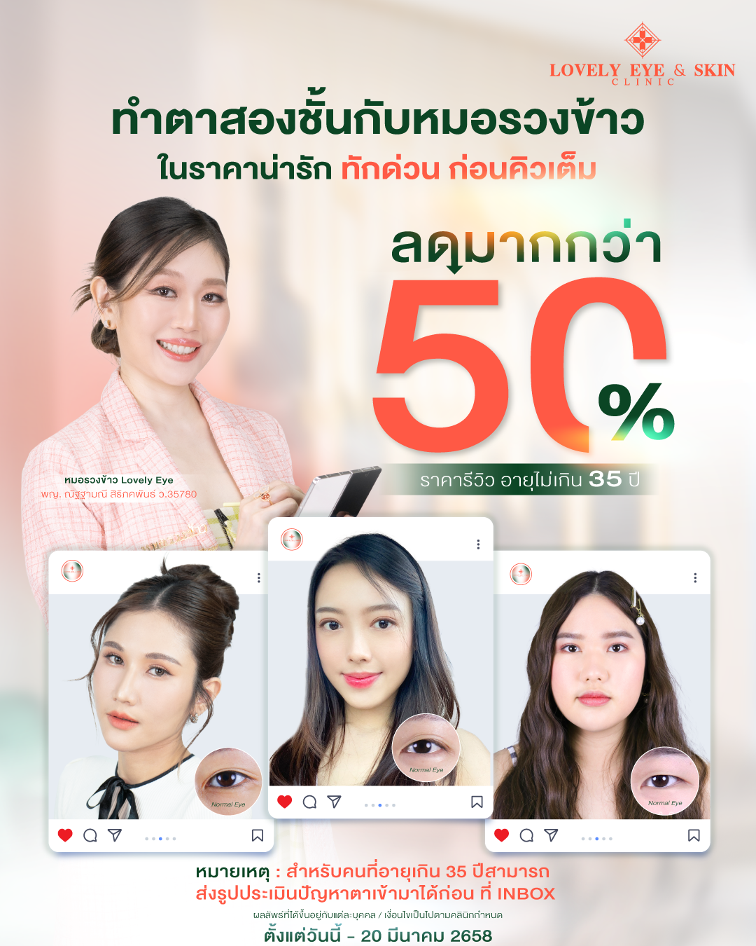 Promotion Lovely Eye Clinic