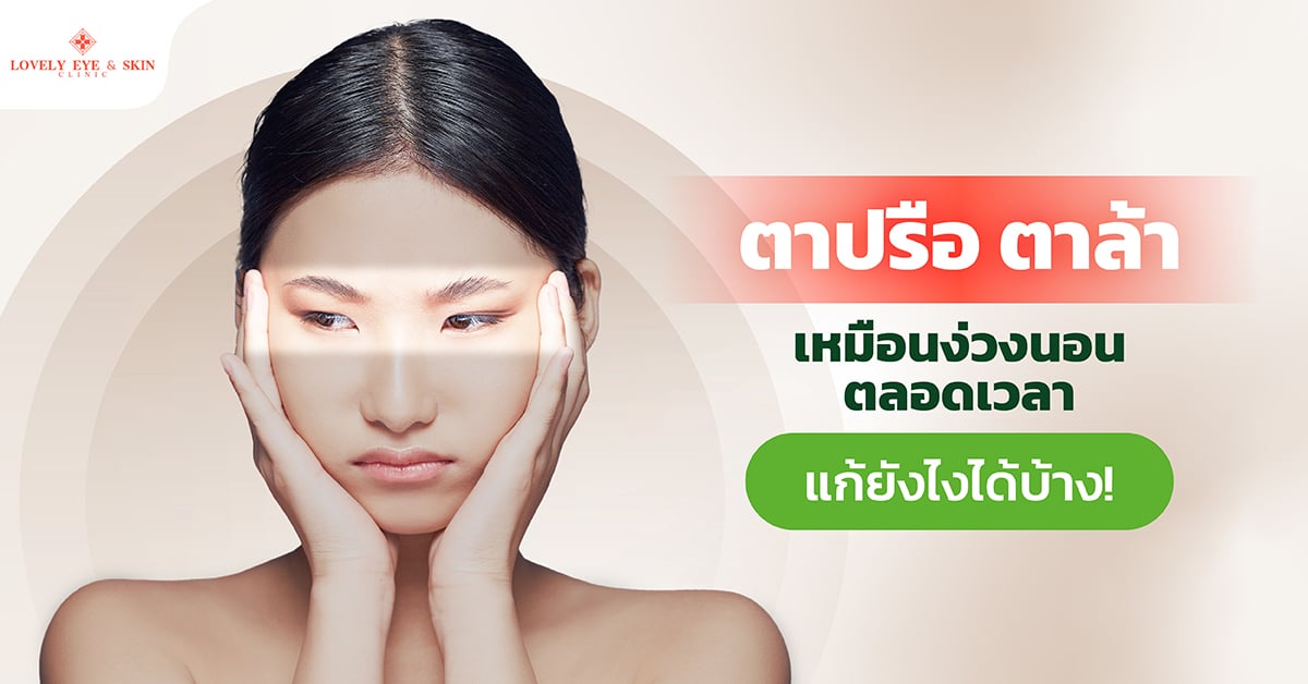 Ptosis ตาปรือ