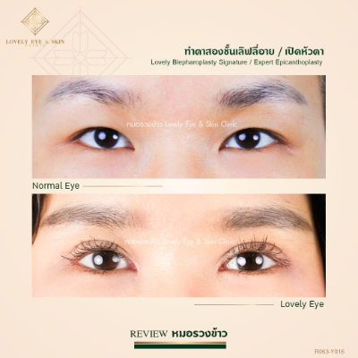 R063-Y016 ทำตา เปิดหัวตา_0.jpg