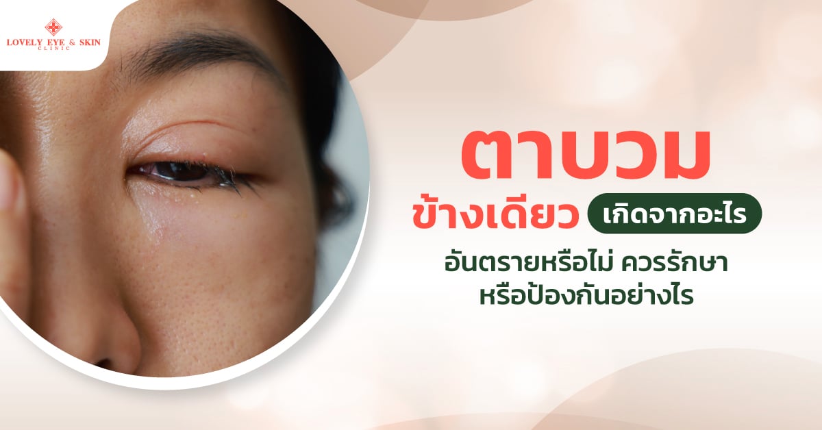 ตาบวมข้างเดียวเกิดจากอะไร อันตรายหรือไม่ ควรรักษาหรือป้องกันอย่างไร