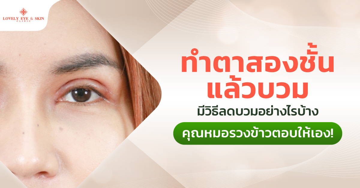วิธีลดบวมหลังทำตา ทำตาสองชั้นตาบวมนาน