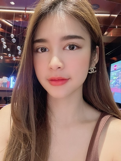 หลังเปิดหัวตา+เปิดหางตา 1 เดือน ตาโตขึ้นจนเพื่อนทัก