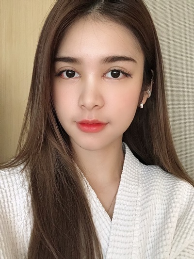 หลังเปิดหัวตา+เปิดหางตา 5 วัน ตึงน้อยลง หลับตาได้สนิท
