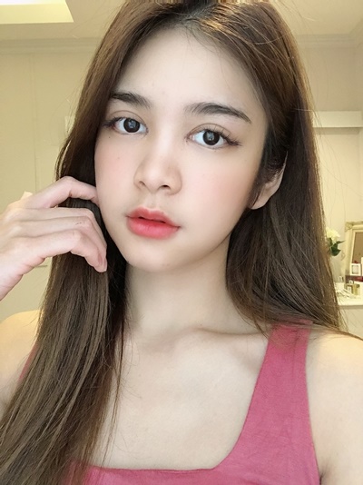 หลังเปิดหัวตา+เปิดหางตา 8 วัน แทบไม่เห็นรอยแผล