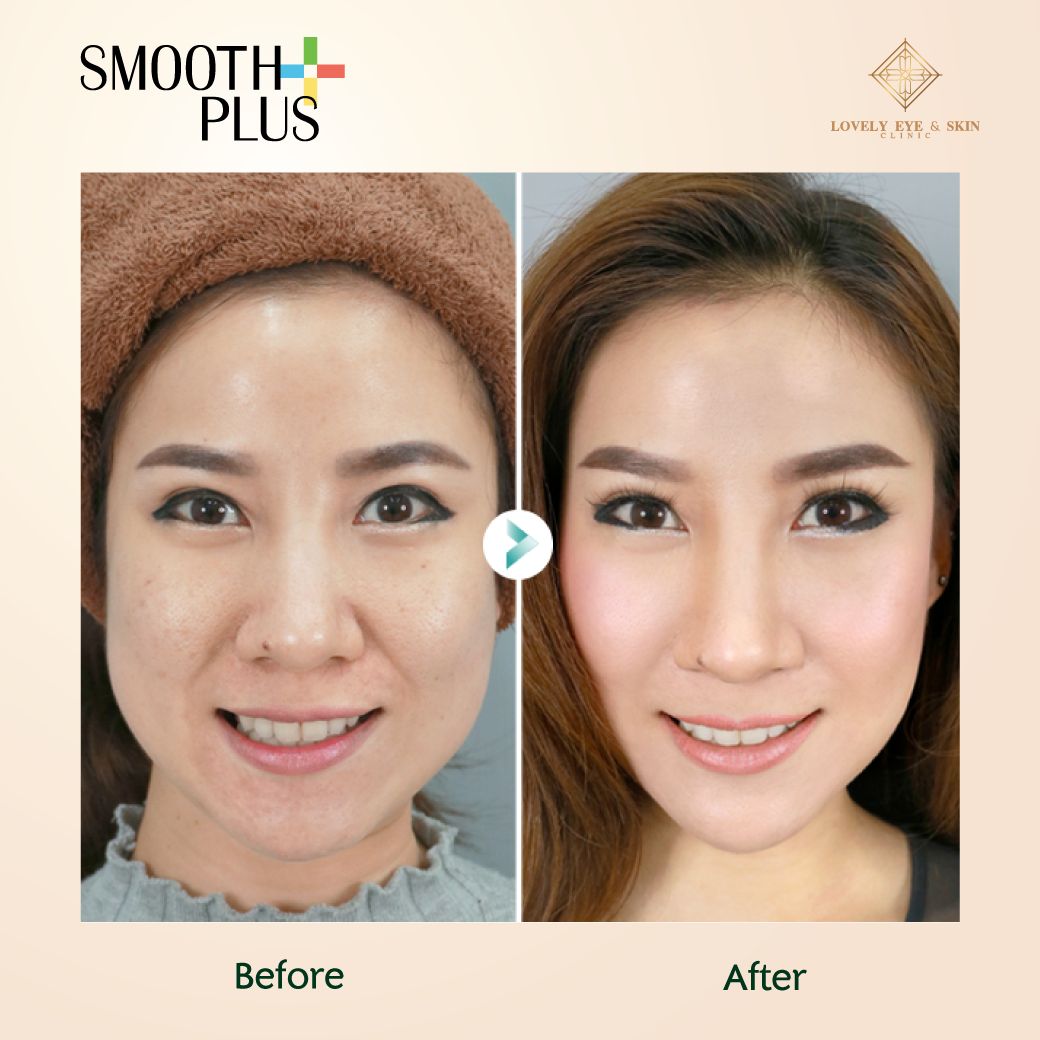 Smooth-Plus.jpg