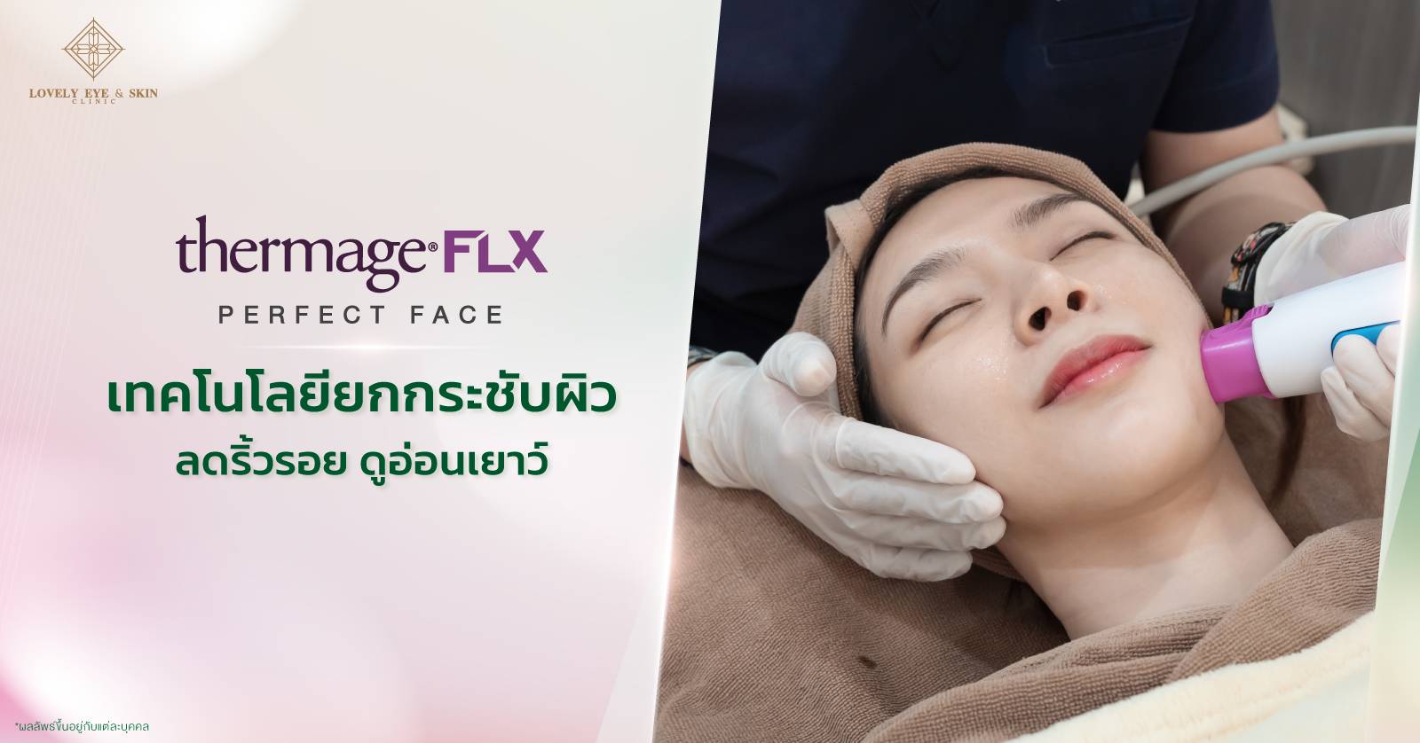 ขั้นตอนการทำ Thermage FLX