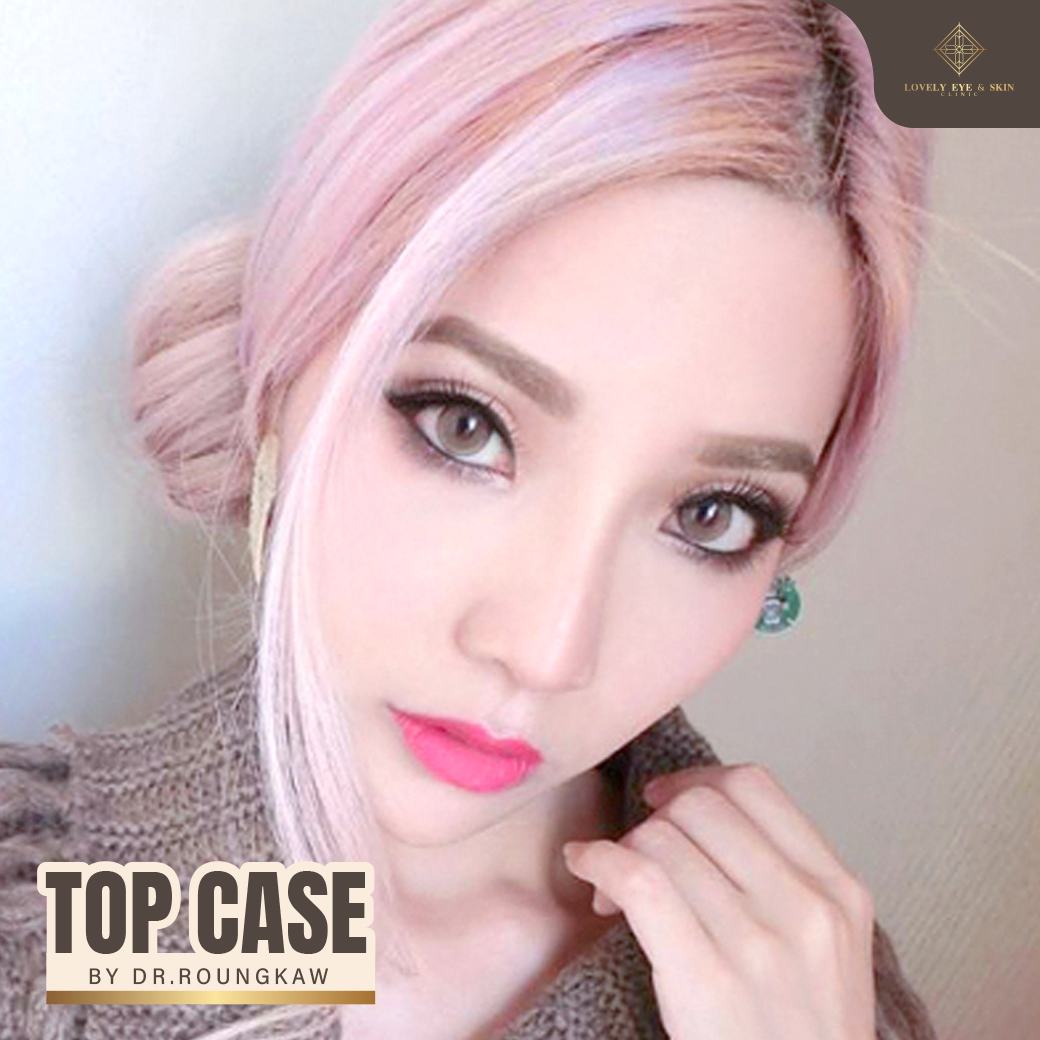 รีวิวตาสายฝอ ทำตาสองชั้นกับหมอรวงข้าว