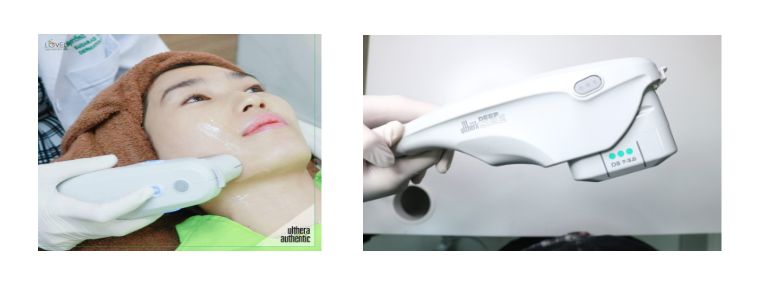 Ulthera​ ยกกระชับผิวหน้า ย้อนวัย โดยไม่ต้องผ่าตัด.jpg