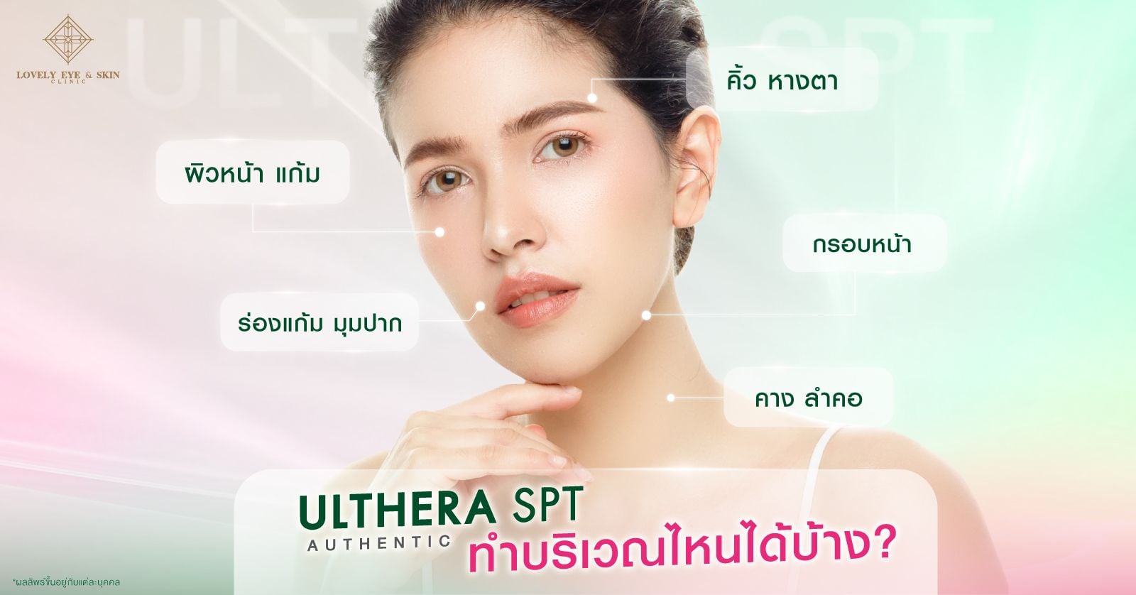 ทำ Ulthera บริเวณไหนได้บ้าง คิ้ว หางตา ช่วยยกคิ้ว ยกหางตา