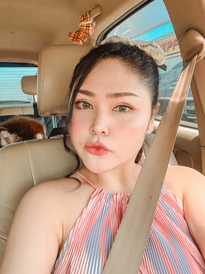 หลังทำตาสองชั้น+เปิดหัวตา ชั้นตาออกมาสวย เส้นคมชัด หัวตาเปิด