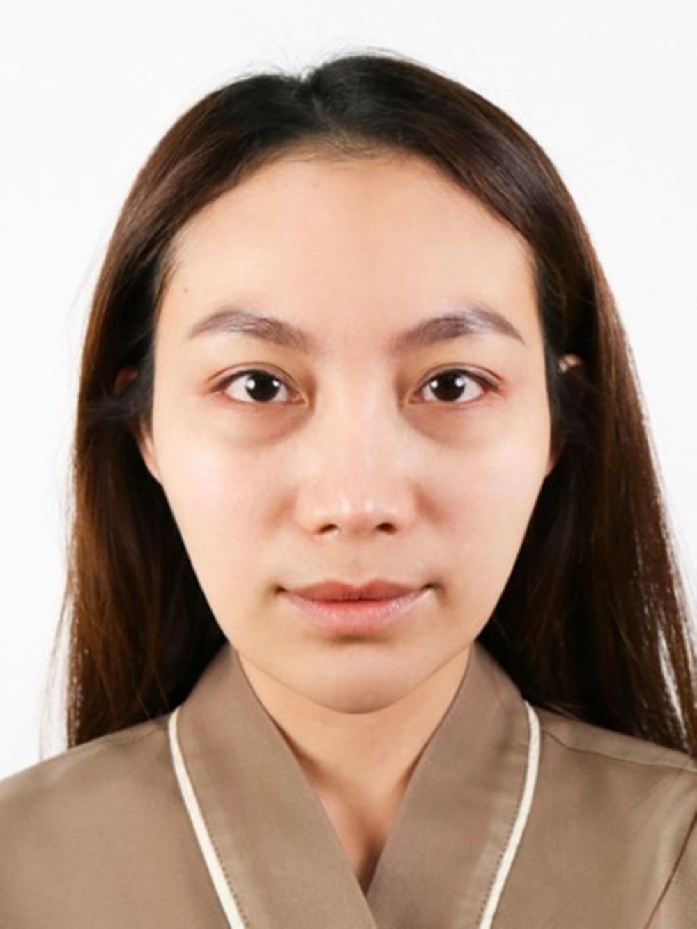 ตัดถุงใต้ตา