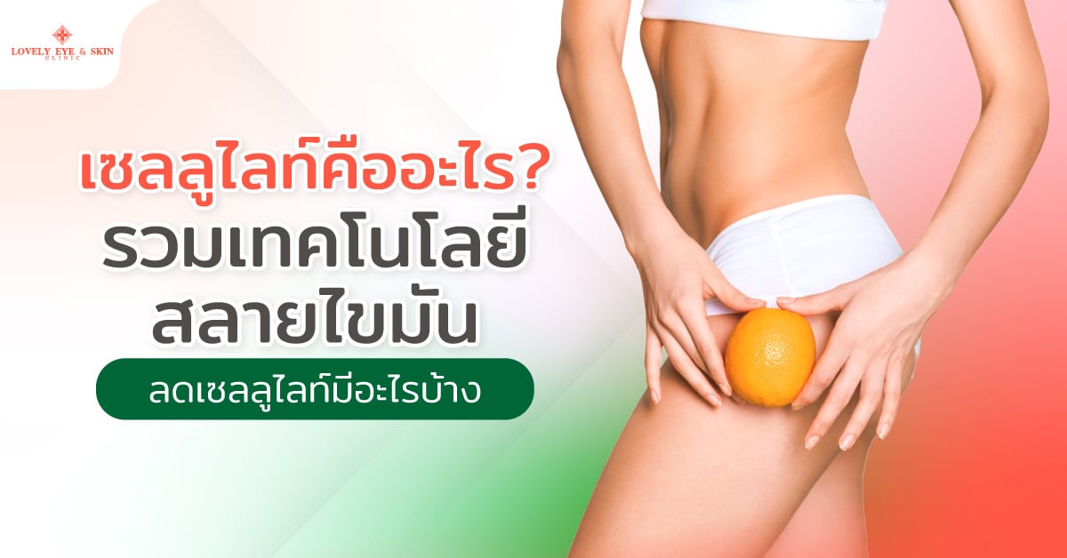 เซลลูไลท์คืออะไร? รวมเทคโนโลยีสลายไขมัน ลดเซลลูไลท์มีอะไรบ้าง