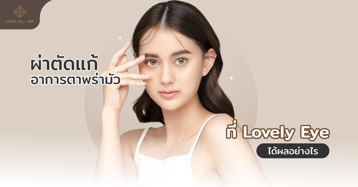 การผ่าตัดแก้อาการตาพร่ามัว จากภาวะกล้ามเนื้อตาอ่อนแรง หนังตาตก
