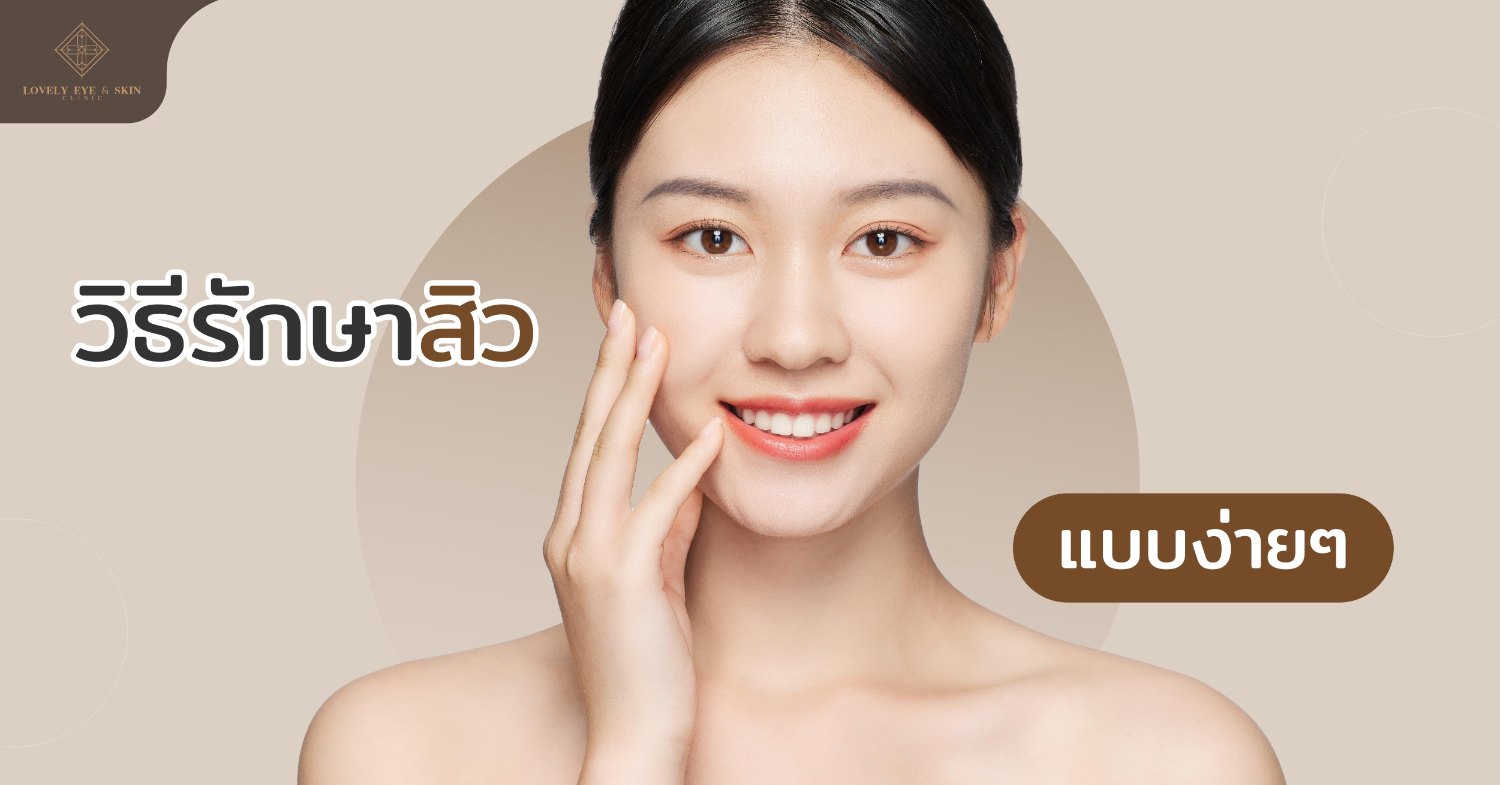 หากเป็นสิวในระยะเริ่มต้น หรือไม่ได้มีความรุนแรง วิธีรักษาสิวเบื้องต้น