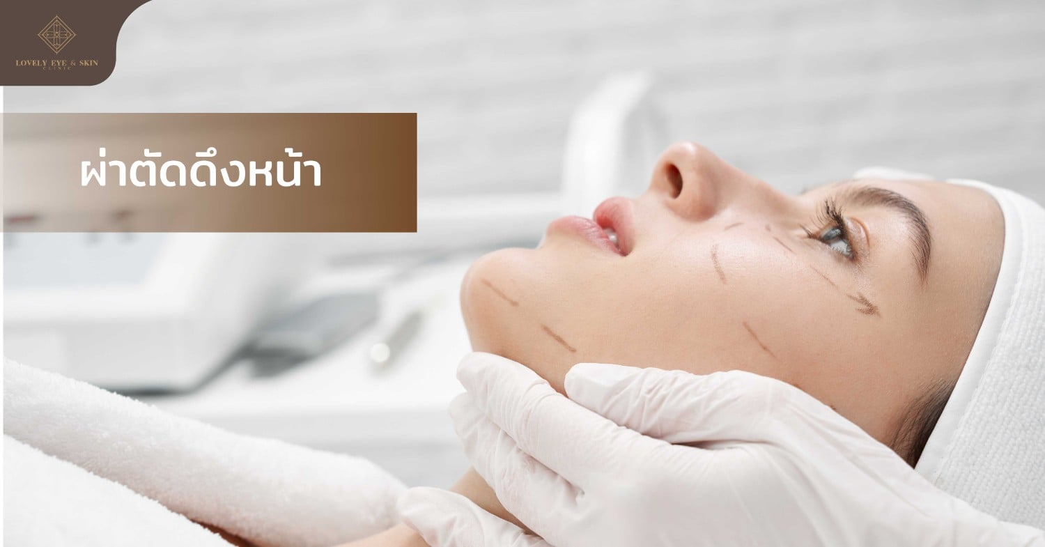 การผ่าตัดกล้ามเนื้อและไขมันบนใบหน้า เป็นการยกกระชับ ลดความหย่อนคล้อย