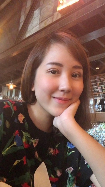 ทำตาสองชั้น+เปิดหัวตา 14 วัน ชั้นตาเริ่มเข้าที่ ตาหวานขึ้น