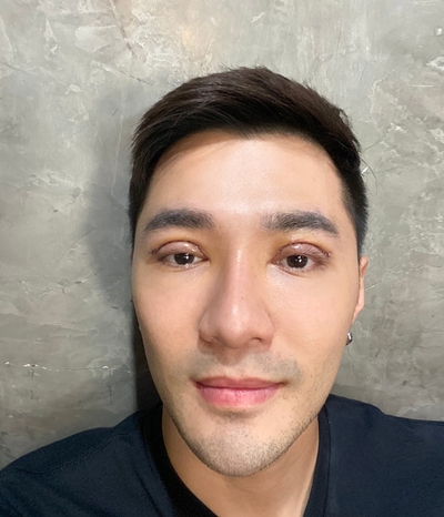 แก้ตาสองชั้น