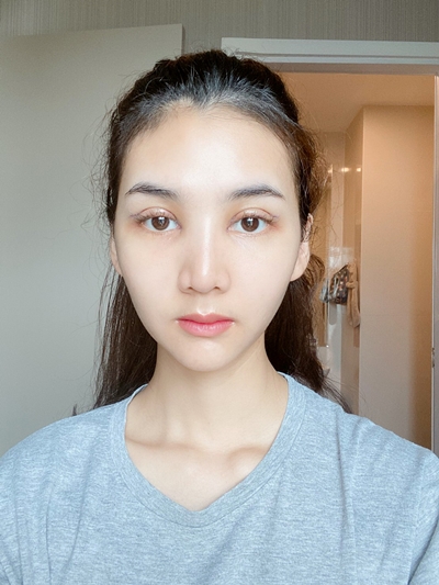 ทำตาสองชั้น เปิดหัวตา หางตาตก