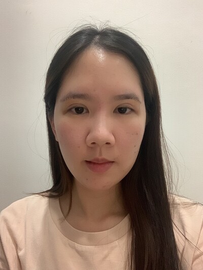 ยกหางตาซ่อนแผลใต้คิ้ว ยกใต้คิ้ว หางตาตก Sub-brow lift