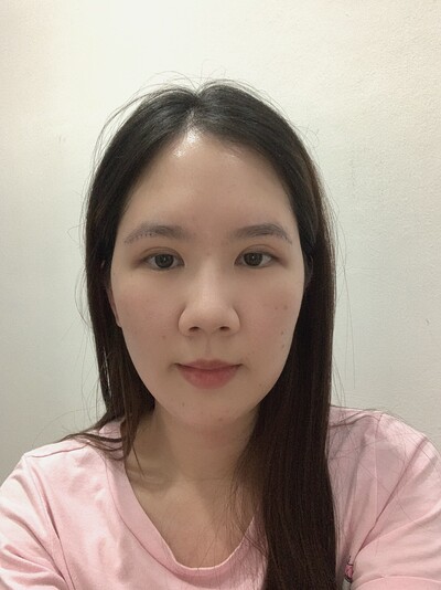ยกหางตาซ่อนแผลใต้คิ้ว ยกใต้คิ้ว หางตาตก Sub-brow lift