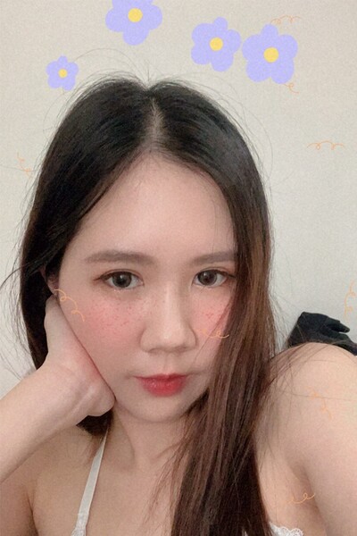 ยกหางตาซ่อนแผลใต้คิ้ว ยกใต้คิ้ว หางตาตก Sub-brow lift