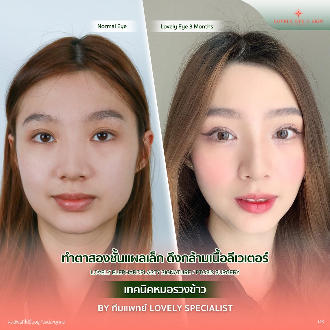 Lovely Eye review ณัฐชริยา เทียนทอง