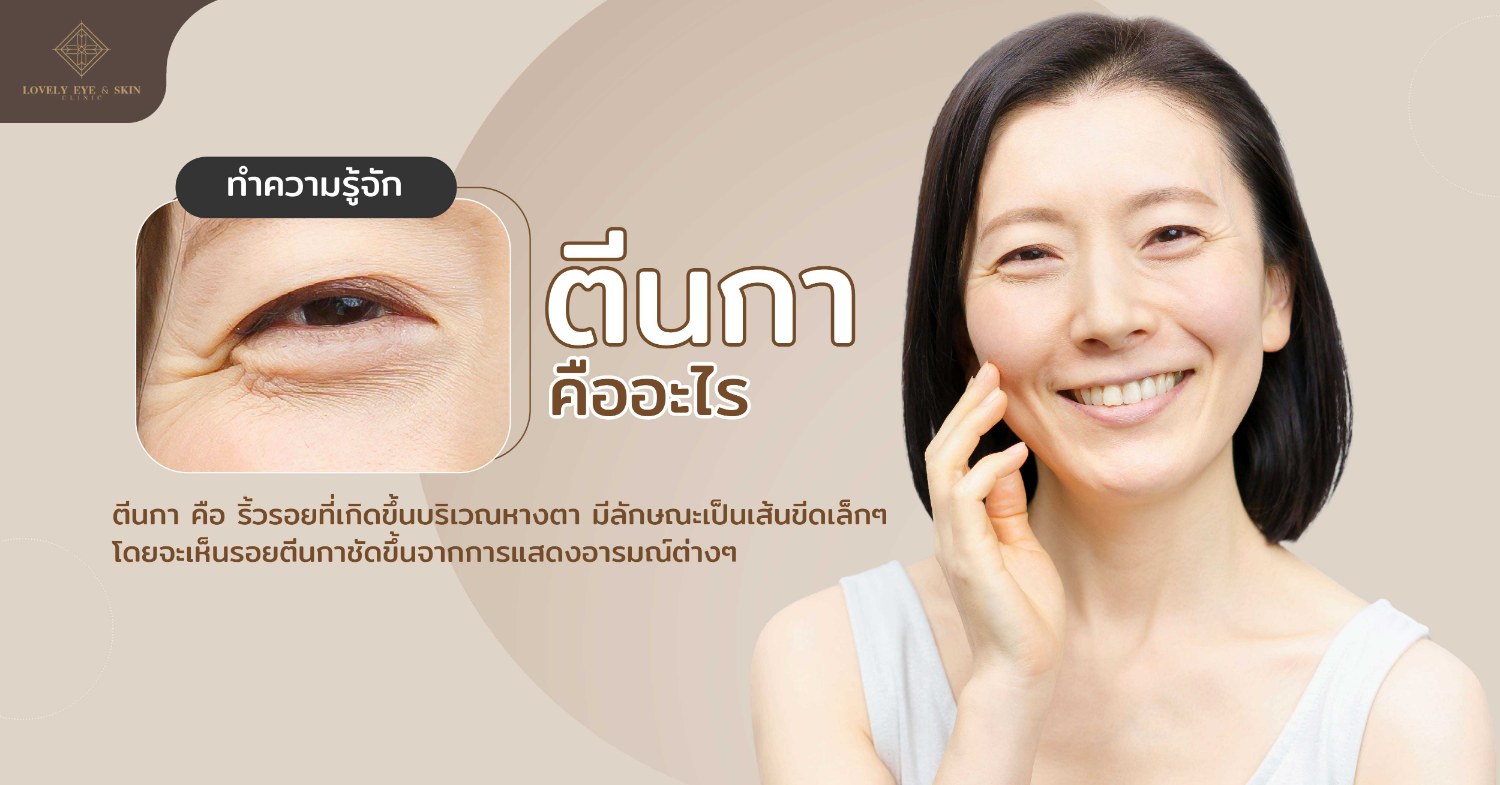 ตีนกา คือ ริ้วรอยที่เกิดขึ้นบริเวณหางตา มีลักษณะเป็นเส้นขีดเล็กๆ โดยจะเห็นตอนแสดงอารมณ์ต่างๆ