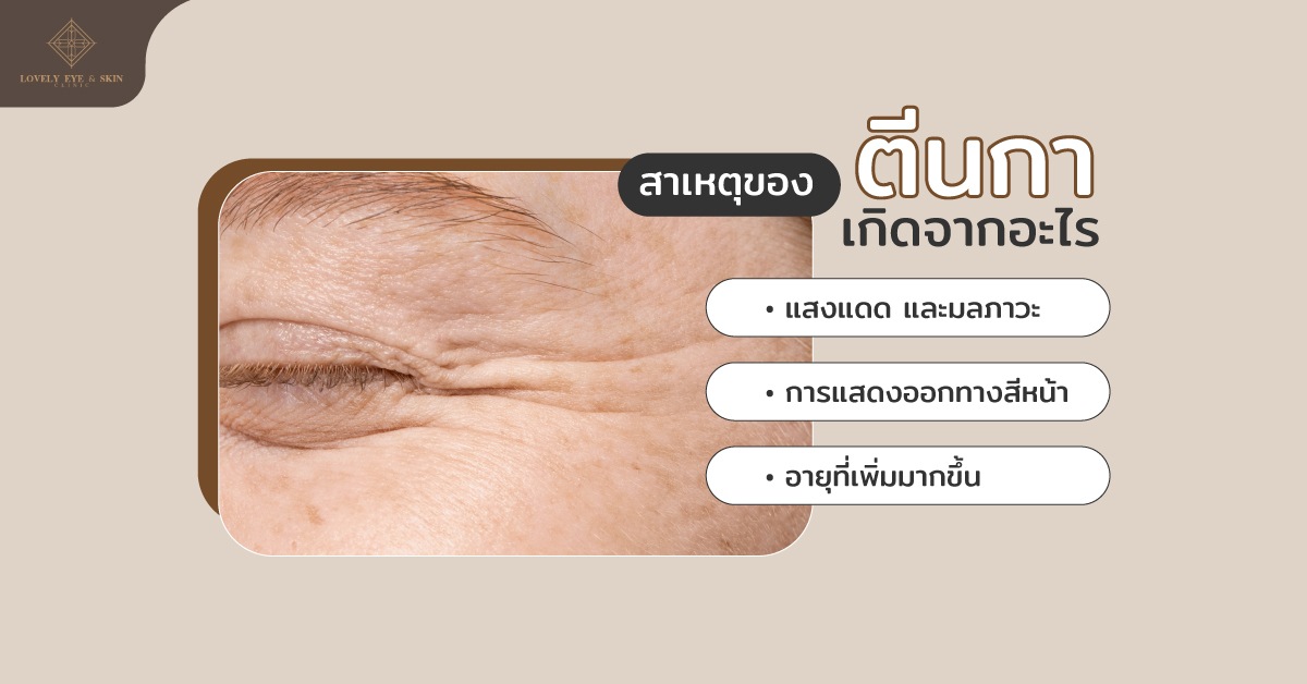 อายุที่เพิ่มมากขึ้นตามวัยเพียงเท่านั้น หากแต่ริ้วรอยตีนกาเกิดได้จากหลากหลายสาเหตุ