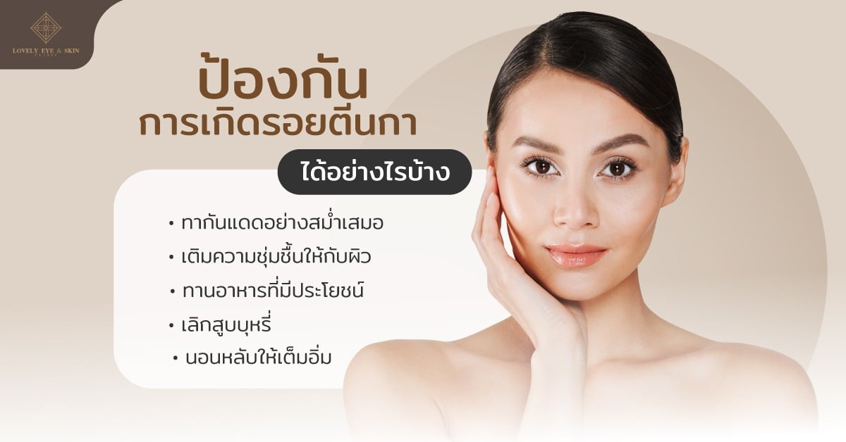 ป้องกันการรักษารอยตีนกาาได้ โดยการทากันแดดอย่างสม่ำเสมอ เติมความชุ่มชื้นให้กับผิว