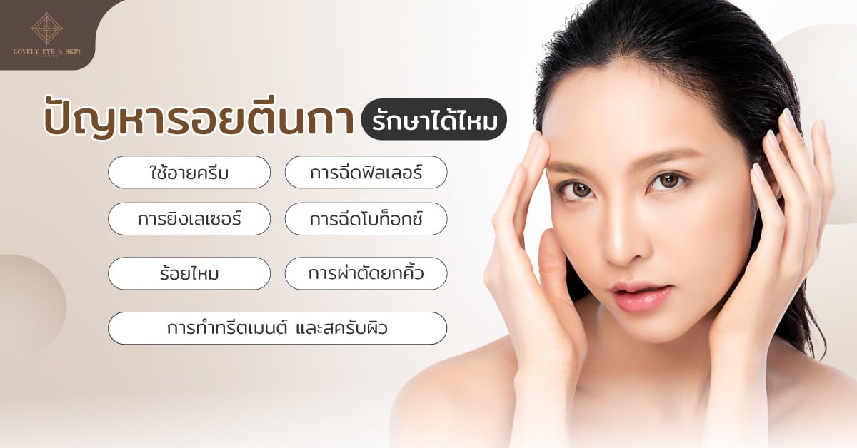 รอยตีนกาจะพรากความมั่นใจให้หายไป แต่ก็สามารถรักษารอยตีนกาได้ด้วยวิธีที่หลากหลาย
