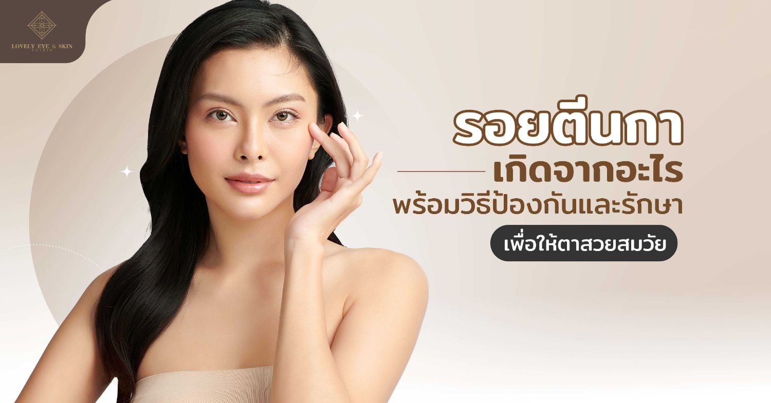 เจาะลึกว่าตีนกาคืออะไร รอยตีนกาเกิดจากอะไร มีวิธีป้องกันและรักษาตีนกาอย่างไร