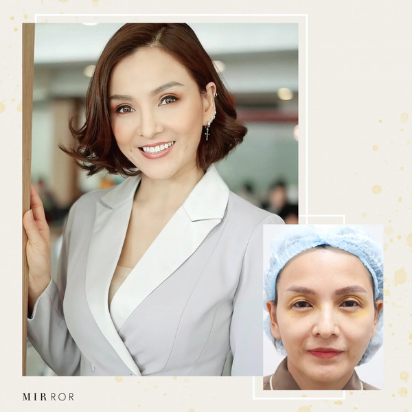 แก้ตาพัง แก้ตาสองชั้น เทคนิคหมอรวงข้าว ไทยรัฐ