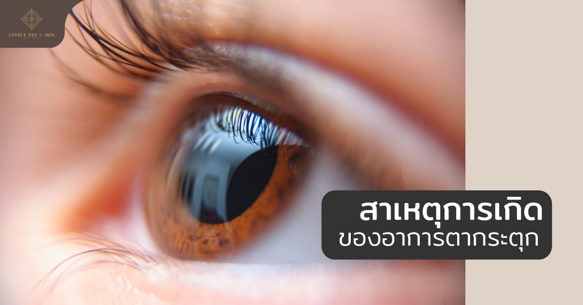 สาเหตุการเกิดของอาการตากระตุก ตาแห้ง ตาล้า จากการระคายเคือง หรือพักผ่อนน้อย
