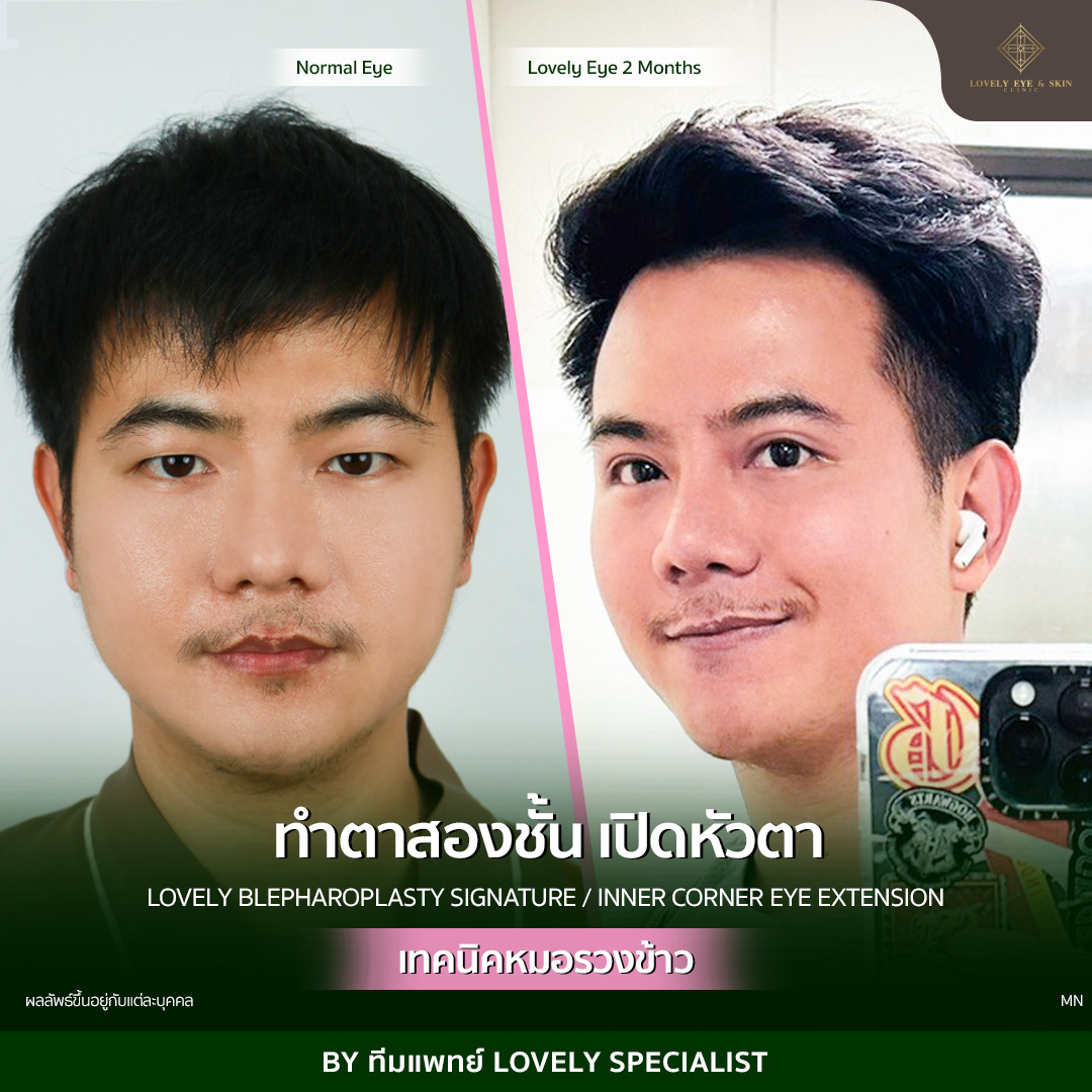 ตาชั้นเดียว โหงวเฮ้ง
