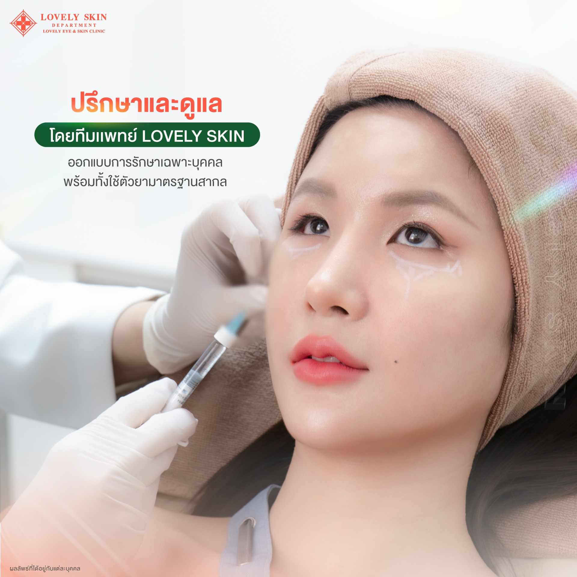 Injected filler