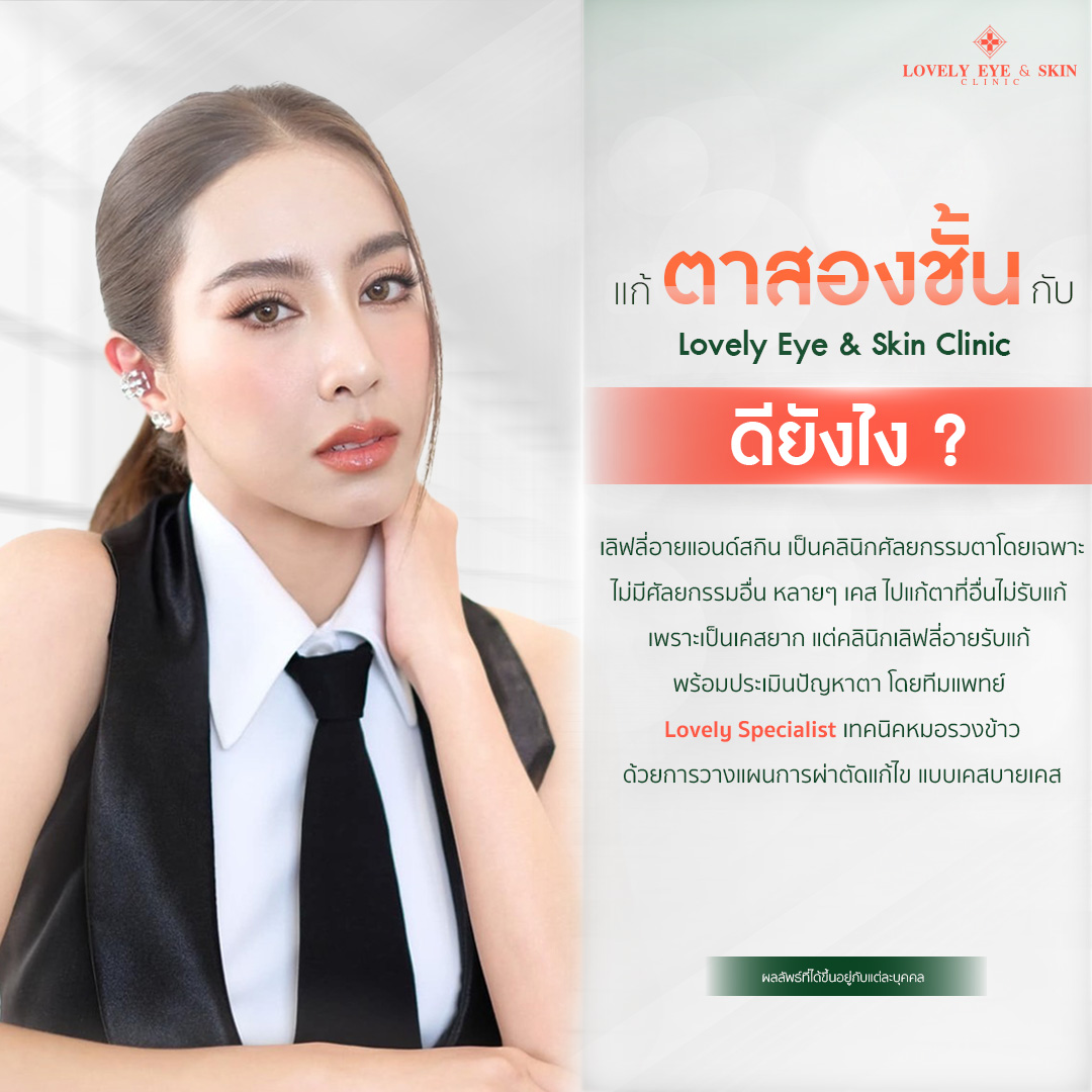 แก้ตาสามชั้นที่ Lovely eye