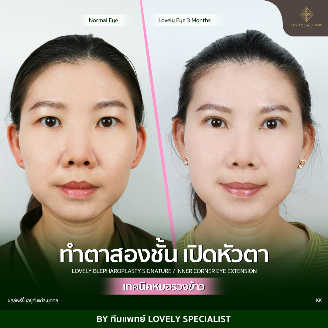 ตาชั้นเดียว มีเสน่ห์